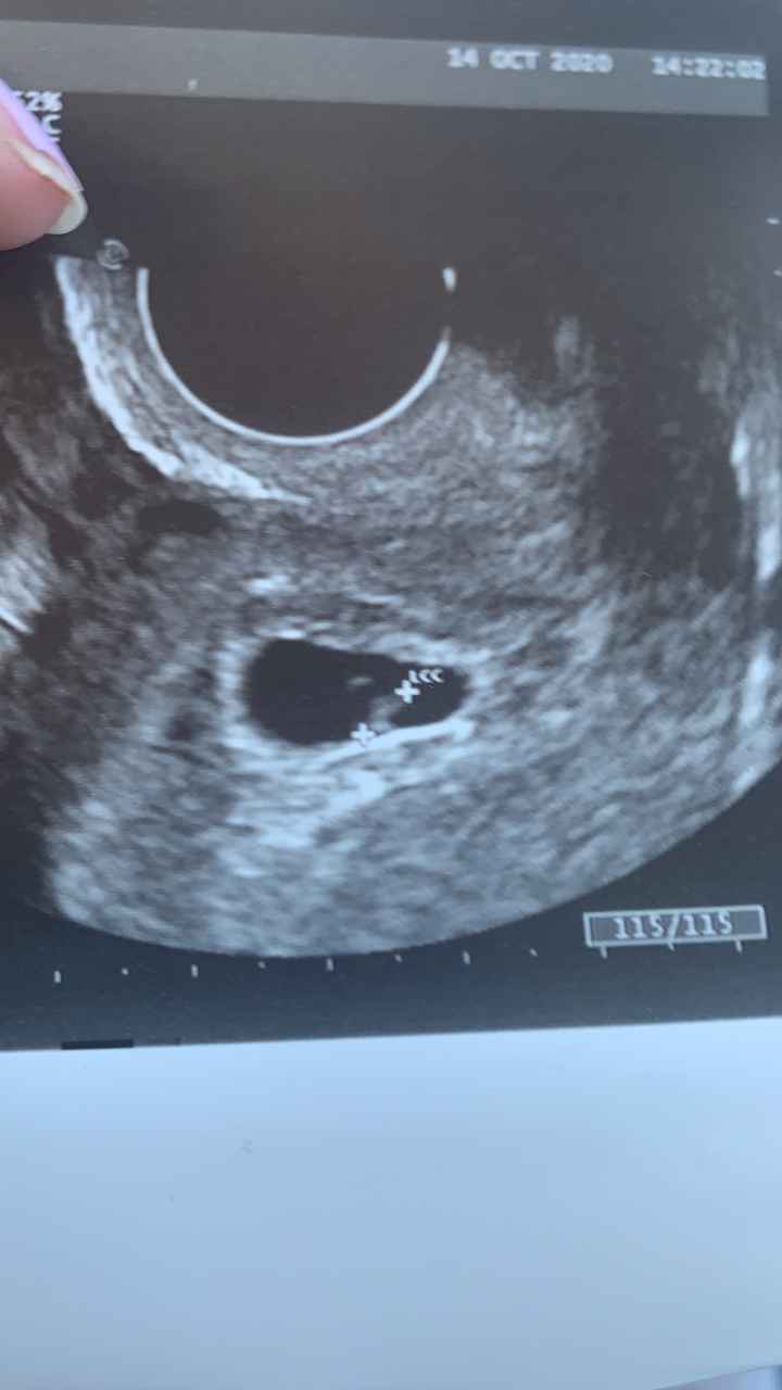 Futuras mamis junio 2021 🤰🏻❤️ oficial - 1