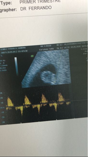 Futuras mamas Diciembre 2020 - 1