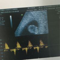 Futuras mamas Diciembre 2020 - 1