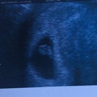 Ayuda con método ramzi: niño o niña? - 1