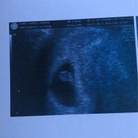 Ayuda con método ramzi: niño o niña? - 1