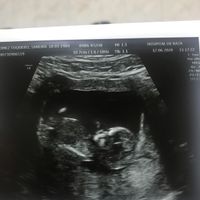 Futuras mamas Diciembre 2020 - 1