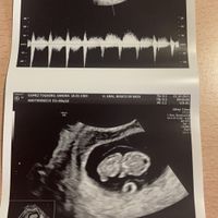 futuras mamis mayo 2022 🤰 - 1