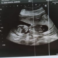Futuras mamis septiembre 2022!!🤰 - 1