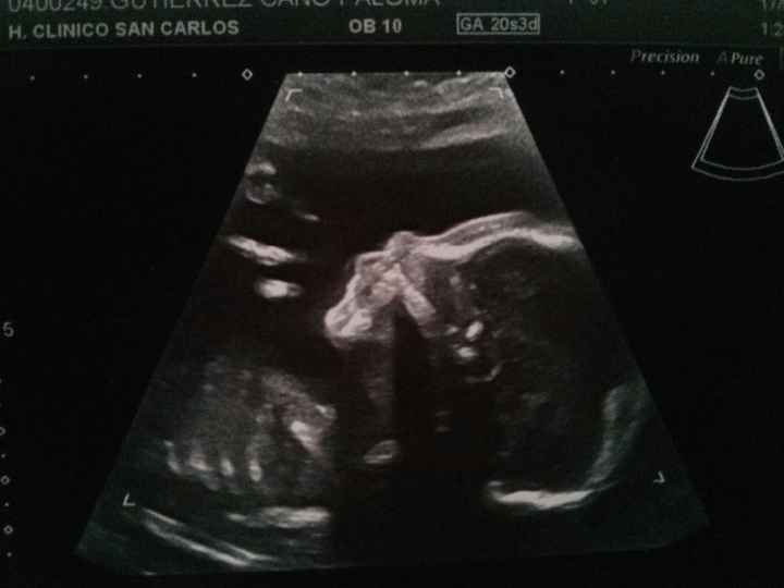 Oliver 20+3