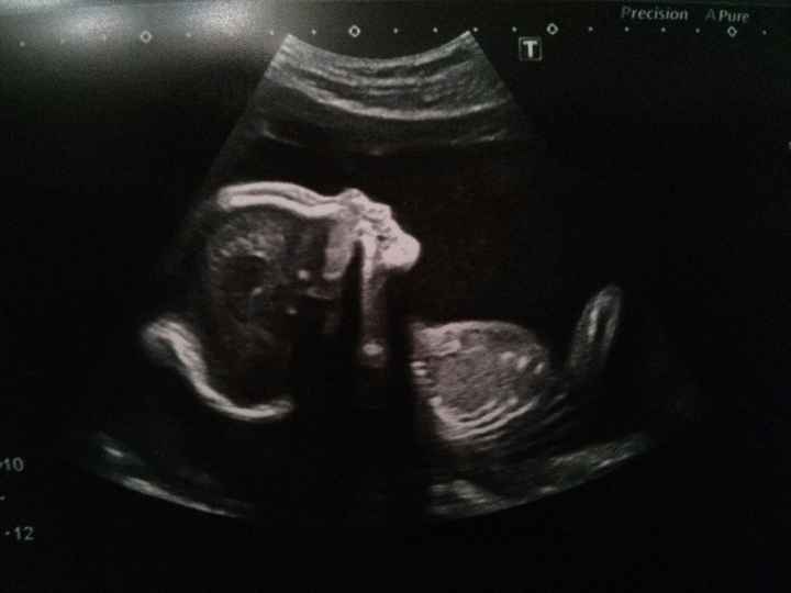 Alejandro 20+3