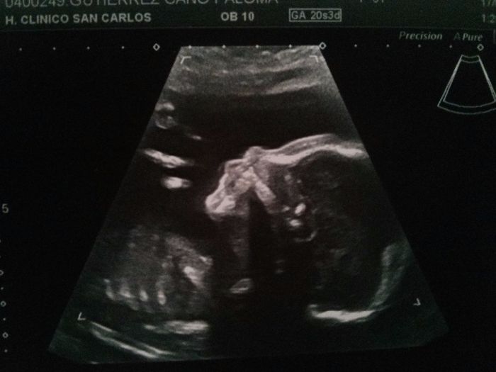 Oliver 20+3