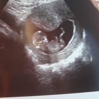 Futuras Mamas Julio 2020. - 1
