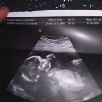 Mi niño jjj