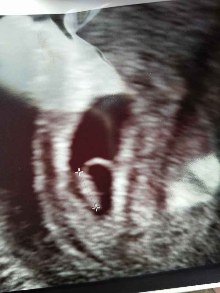Futuras mamas octubre 2020 - 1