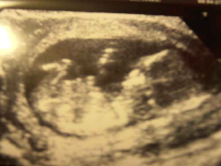 mi bebe 