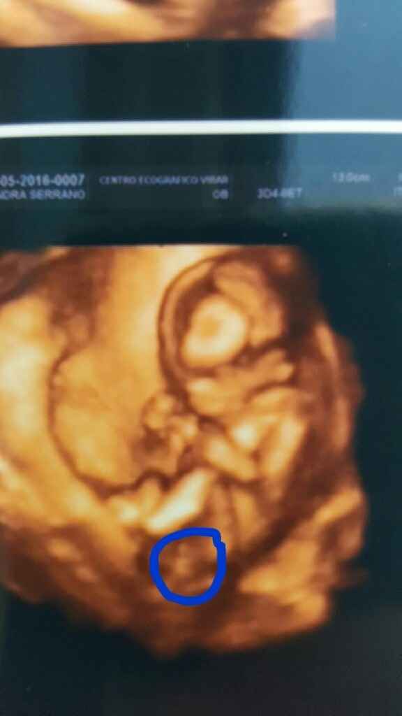 ¡futuras mamis noviembre 2016! - 1