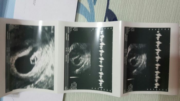 ¡futuras mamis noviembre 2016! - 1