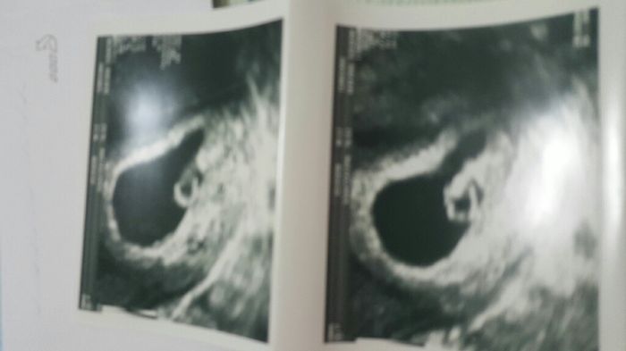 ¡futuras mamis noviembre 2016! - 2