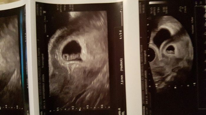 ¡futuras mamis noviembre 2016! - 1