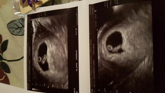 ¡futuras mamis noviembre 2016! - 2