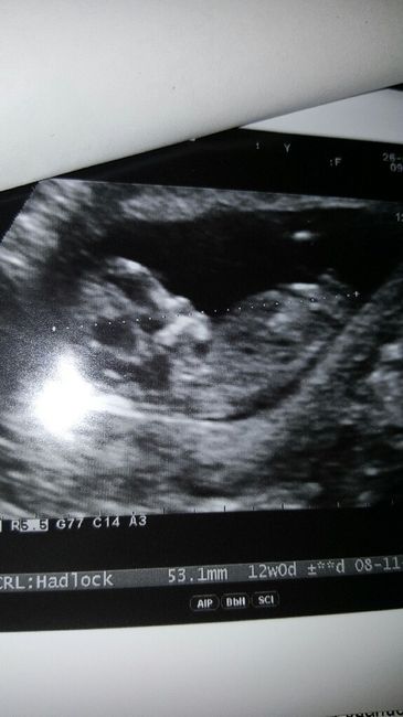 ¡futuras mamis noviembre 2016! - 1