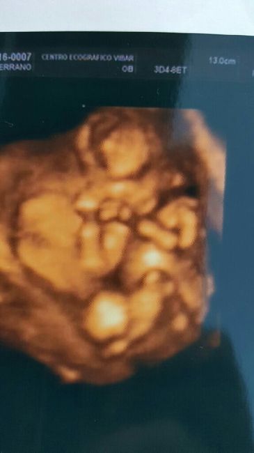 ¡futuras mamis noviembre 2016! - 2