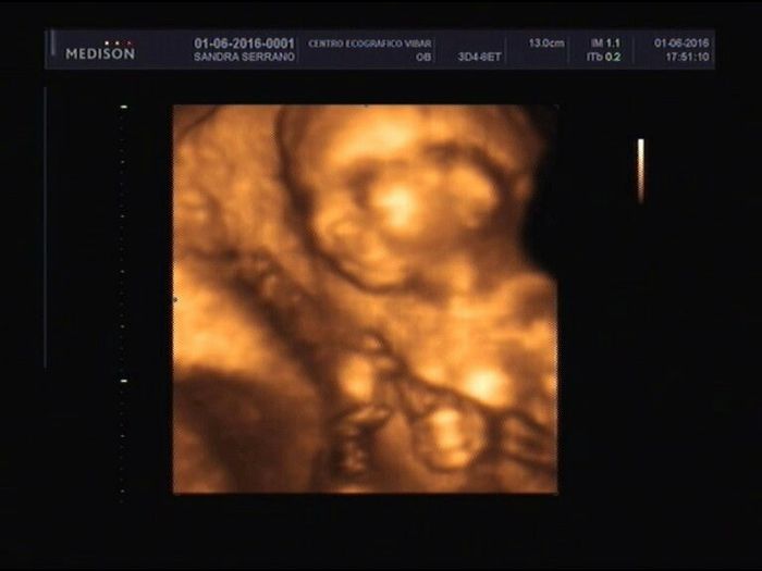 ¡futuras mamis noviembre 2016! - 1