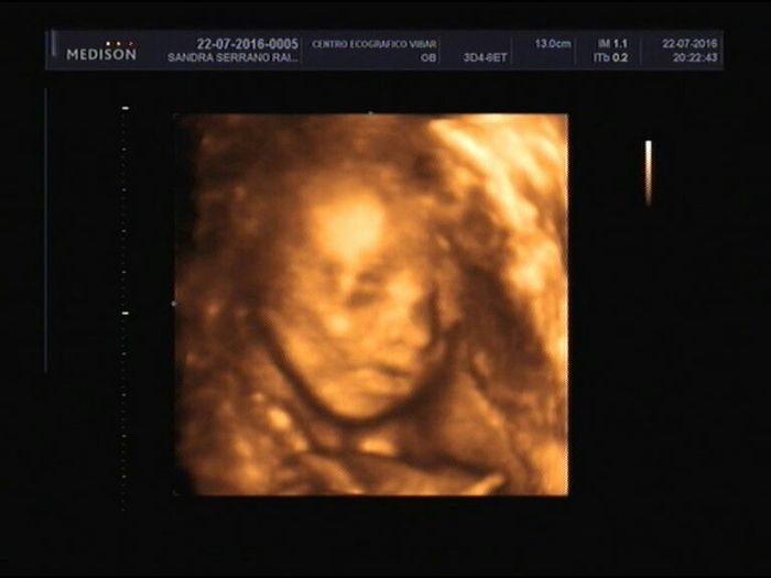 ¡futuras mamis noviembre 2016! - 2