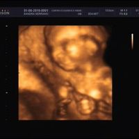 ¡futuras mamis noviembre 2016! - 1