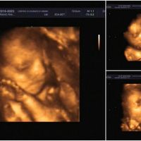 ¡futuras mamis noviembre 2016! - 1