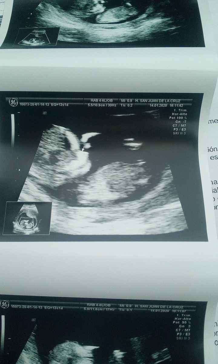 Es un niño o una niña???? 1