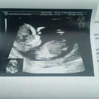 Es un niño o una niña???? - 1