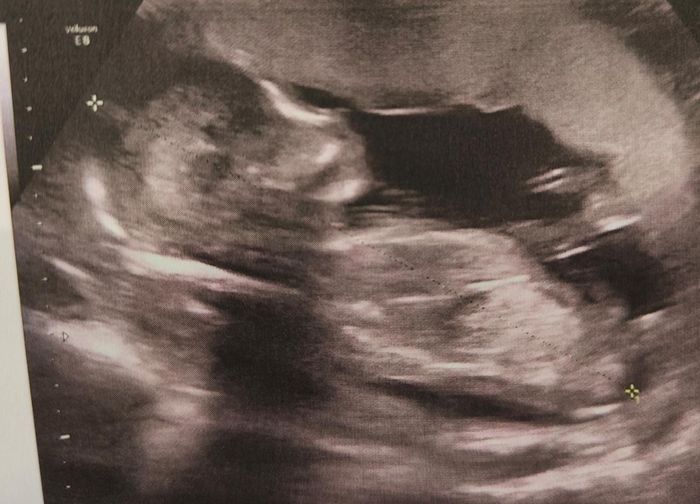 Futuras mamis mayo 2023 1
