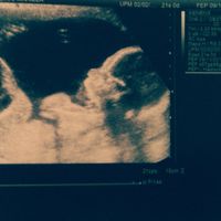 Mamás noviembre 2015 - 2