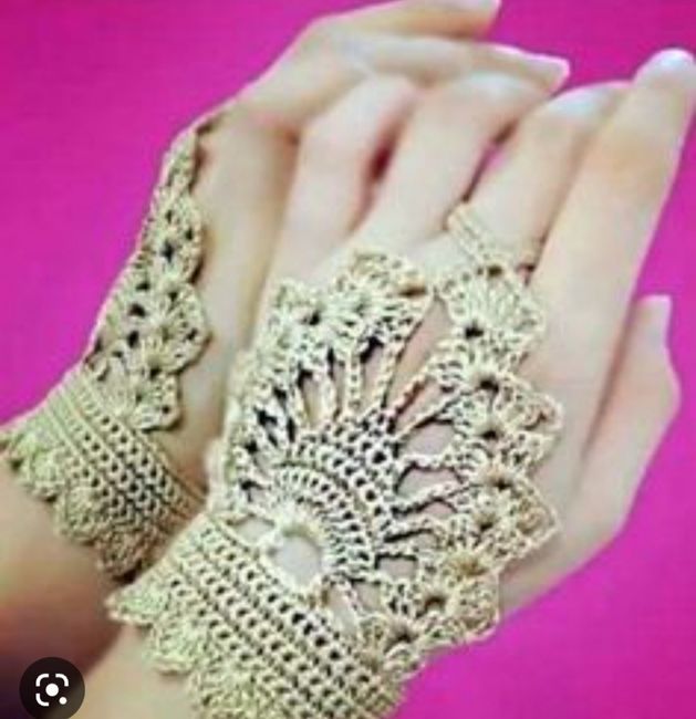 ¿Guantes sí o no? Novia con vitíligo en las manos 2