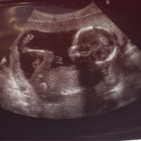 Futuras mamás abril 2017 - 1