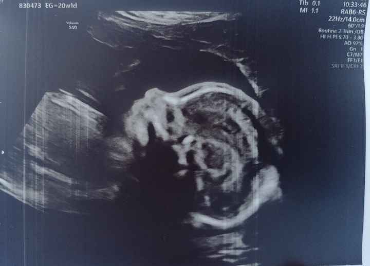 Futuras mamas noviembre 2020 - 1