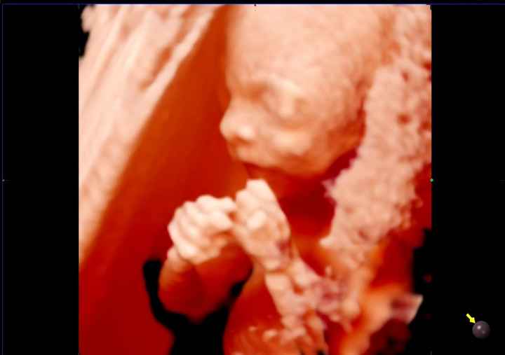 Futuras mamas noviembre 2020 - 3