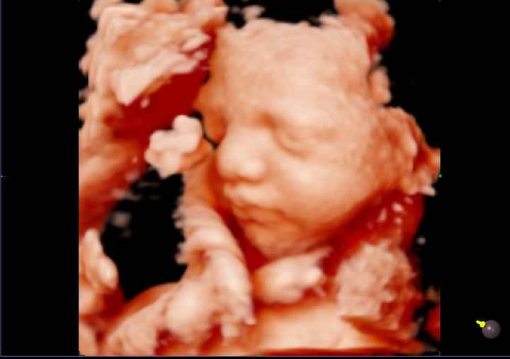 Futuras mamas noviembre 2020 - 2