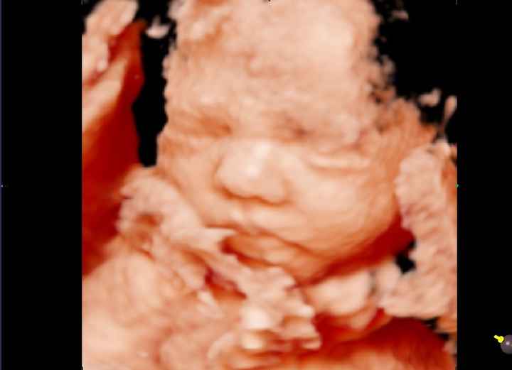 Futuras mamas noviembre 2020 - 4