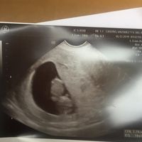 Futuras Mamas Julio 2020. - 1