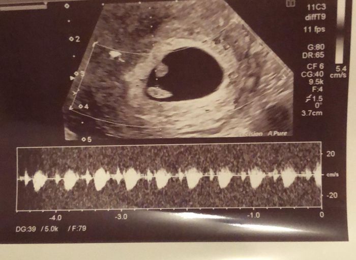 futuras mamis mayo 2022 🤰 2