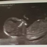 Ayuda con método ramzi: niño o niña? - 2