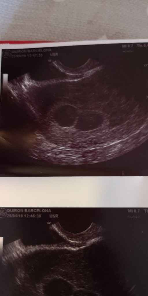 Futuras mamas diciembre 2019 - 3