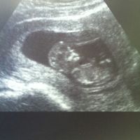 12 semanas
