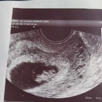 Futuras Mamis Enero 2021 - 1