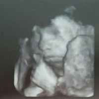 Futuras mamás abril 2017 - 1