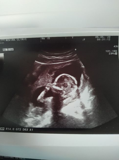 Futuras mamas octubre 2020 - 1