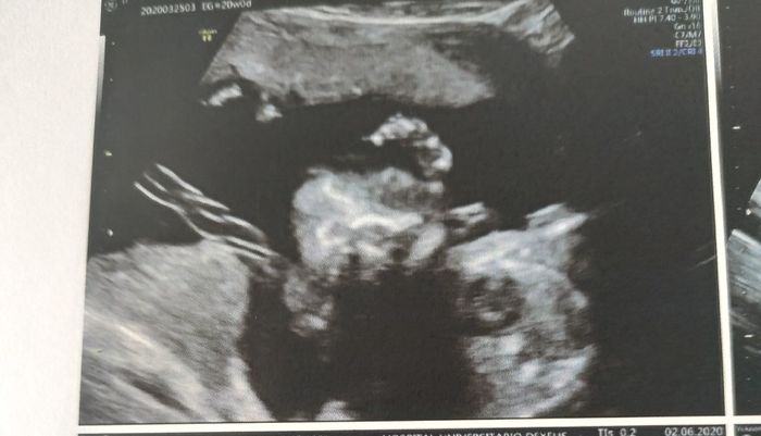 Futuras mamas octubre 2020 - 1