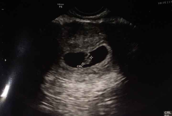 Semana 6 vaginal