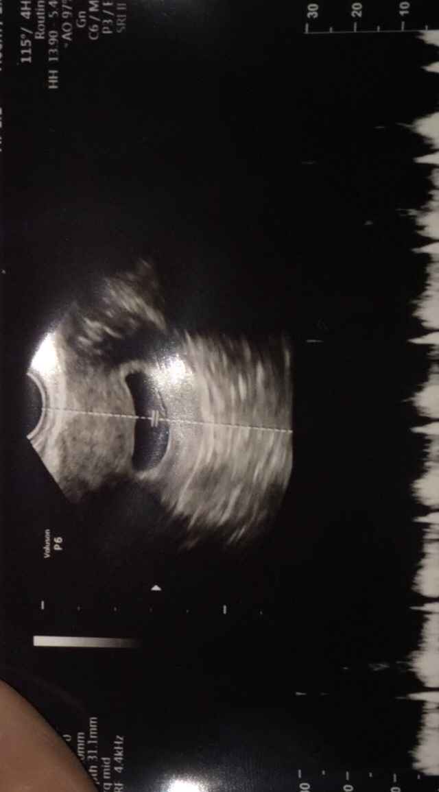Xxxxx