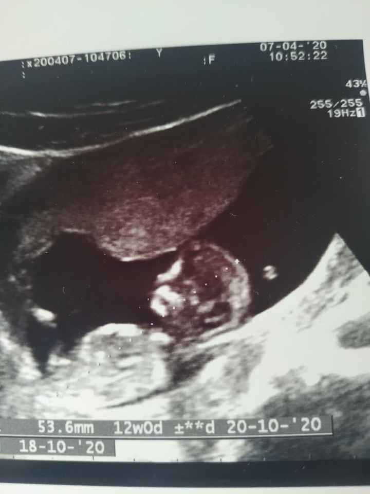 Futuras mamas octubre 2020 - 1