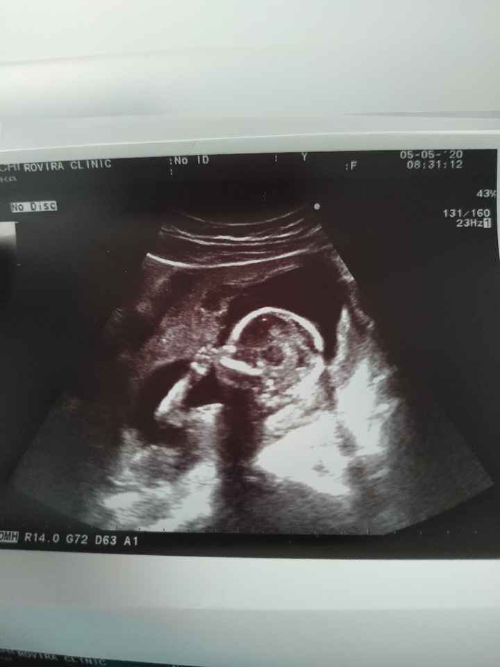 Futuras mamas octubre 2020 - 1