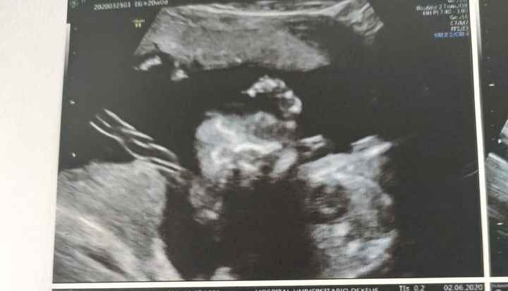 Futuras mamas octubre 2020 - 1